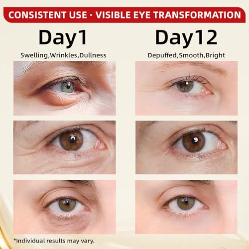 Caffeine Eye Serum for Dark Circles & Puffiness - Anti-Wrinkle, Firming & Smooths Fine Lines - Retinol Under Eye Serum Treatment - 0.7 Fl Oz
