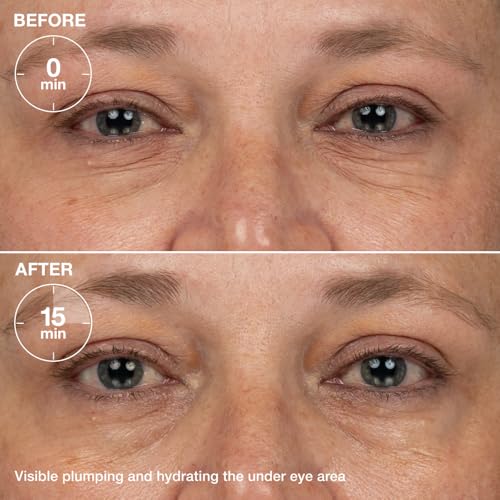 Protagonist 5-in-1 Tightening Radiance Serum, Niacinamide, Caffeine, Hyaluronic Acid, Exfoliating & Plumping Moisturizer for Face & Eyes