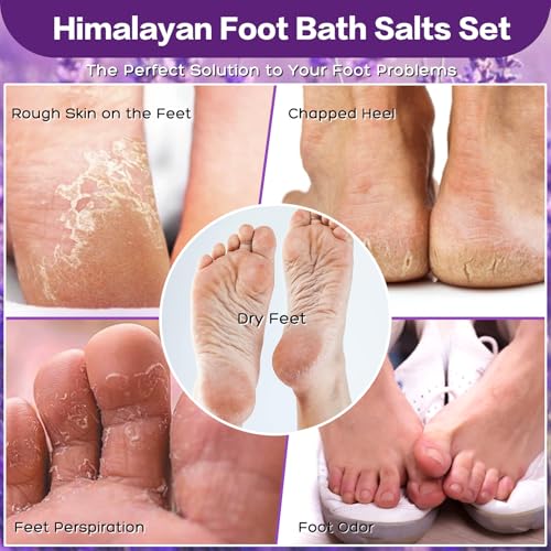 4 Pack Foot Soak Salts Kit Himalayan Pink Salt Tea Tree Oil Lavender rose Pure Epsom Salt Soak Pedicure Salt Softens Calluses & Soothes Foot Care Gifts for Mom women