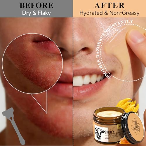 Grass-Fed Beef Tallow Balm for Men - Whipped Tallow Face Moisturizer & Beard Balm with Manuka Honey - Natural After Shave Care for Dry & Sensitive Skin, 2.1 oz
