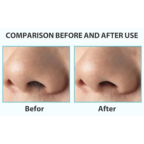 12pcs Nasal Hair Cutter,Double Sided Nose Hair Cutter, Portable 360¡Æ Rotating Manual Nose Hair Trimmer for Men and Women