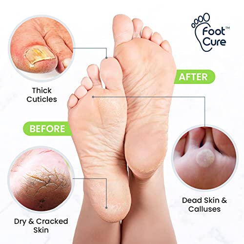 Tea Tree Foot Soak, Callus Remover Gel - Extra Strength Callus Remover Gel & Foot Soak With Epsom Salts For Calluses & Tea Tree Oil Foot Balm/ Moisturizer For Dry Cracked Feet