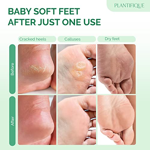 PLANTIFIQUE Foot Peel Mask with Peach 2 Pack and Hydrating Foot Mask for Dry & Cracked Feet