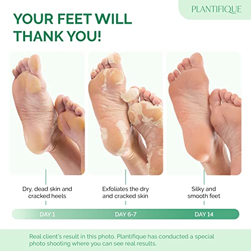 PLANTIFIQUE Foot Peel Mask with Peach 2 Pack and Hydrating Foot Mask for Dry & Cracked Feet