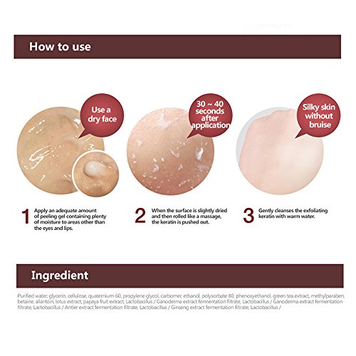 Oriental Medicine Su Peeling Gel 180ml by Arrahan