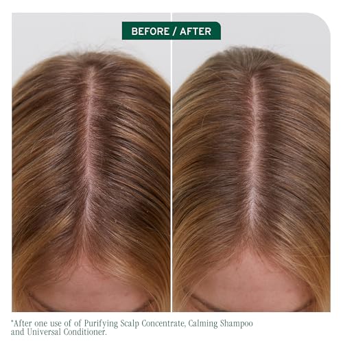 Biolage Scalp Sync Calming Shampoo - Gently Cleanses Dry & Sensitive Scalps, Hydrates & Soothes, Fermented Tea Blend & Glycolic Acid, Vegan & Paraben-Free