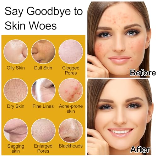 Skin Care Set,6Pcs Women Teen Glass Skincare w/Korean Rice Extract,Hydrate Glow Repair Anti-Aging Facial Routine Kit Self Care Gifts for Women Mom Wife Teenage Girl Her Valentines Day Christmas Gifts