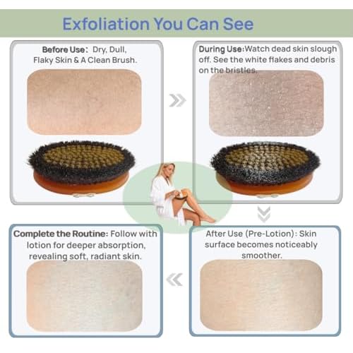 Ionic Copper Dry Brushing Body Brush for Lymphatic Drainage,Exfoliating Body Dry Brush for Radiant Skin,Dry Skin Brush for Cellulite,Blood Circulation Improvement,Reduce Stress