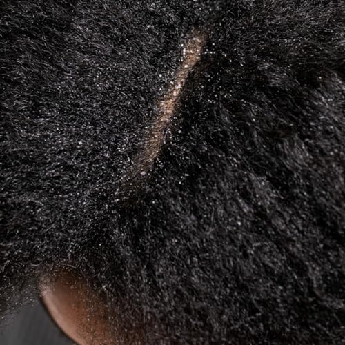 Hairitage Wash It Away Anti-Dandruff Shampoo - For Flaky, Itchy, Dry Scalp - Dandruff Shampoo Treatment - Eliminate Scalp Itching + Irritation + Flaking - 13 fl oz