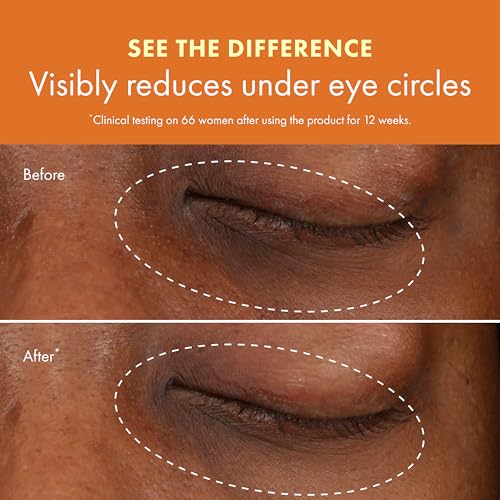 Origins GinZing Brightening Eye Cream with Vitamin C & Niacinamide| Visibly Reduces Dark Circles, 0.5 Fl Oz