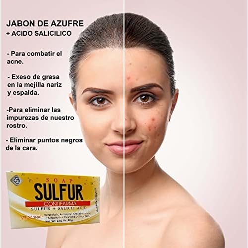 Contifarma AZUFRE + ACIDO SALICILICO, jabon, tratamiento para el acne, sulfur soap, for acne, with salicylic acid, Pack of 1