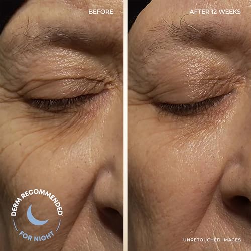 RoC Retinol Correxion Deep Wrinkle Facial Moisturizer Skin Care Bundle: Retinol Correxion Deep Wrinkle Night Cream + Deep Wrinkle Day Cream with SPF 30