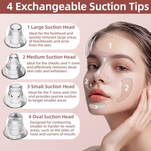 5-Speed ??Blackhead Remover Vacuum, Wireless Charging Nose Pore Extractor with 4 Removable Heads,Facial Vacuum Pore Cleaner,30-Second Keratin Softening, Hypoallergenic Deep Cleansing