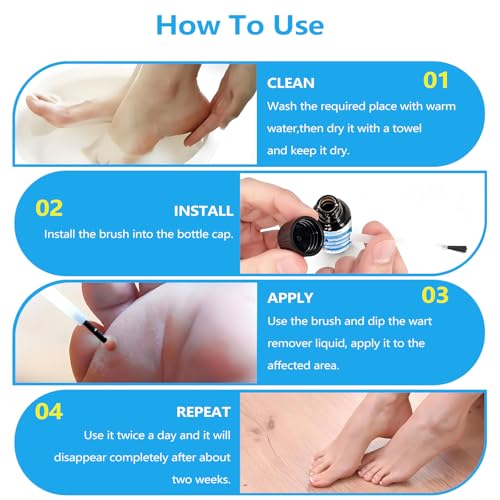Fast Acting Wart Corn Callus Remover, Wart Remover Freeze Off with Salicylic Acid for Plantar Wart, Corn Freeze Off for Men and Women 30 ML.
