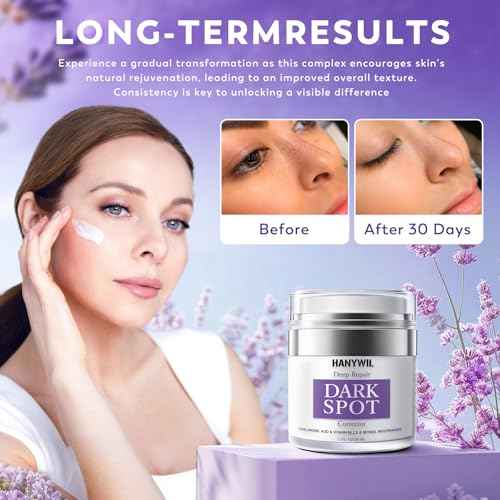 HANYWIL Dark Spot Remover for Face and Body, Remedy for Dark Spots with Natural Ingredients, Dark Spot Corrector Cream and Serum for Skin Care, Treats Freckles, Melasma, Sun Spots, for Women,1.7 Fl Oz