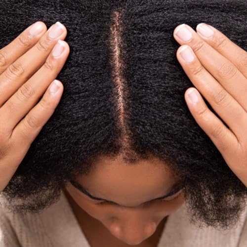 Hairitage Wash It Away Anti-Dandruff Shampoo - For Flaky, Itchy, Dry Scalp - Dandruff Shampoo Treatment - Eliminate Scalp Itching + Irritation + Flaking - 13 fl oz