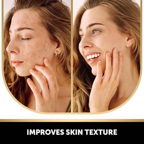 VALITIC Kojic Acid Dark Spot Remover Soap with Turmeric, Vitamin C, Retinol - Original Japanese Complex - Hyaluronic Acid, Vitamin E, Shea Butter, Castile Olive Oil - 3 Pack Bundle with African Net