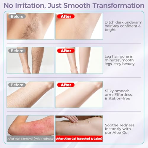 Body Hair Removal Cream for Women with Aloe Gel, 5 Min Painless Flawless Depilatory Cream for Arms, Underarms, Legs, Chest & Bikini Line, Body Hair Remover Dermatologically Tested for All Skin