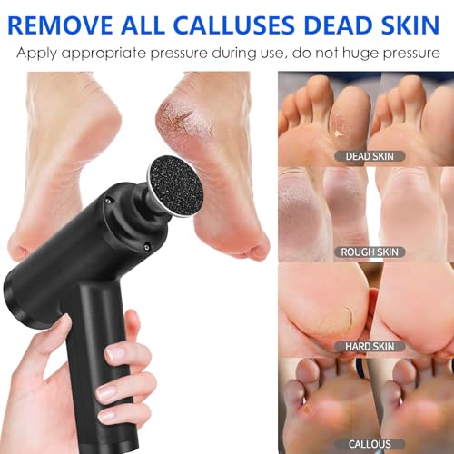 Upgraded Electric Callus Remover for Feet 4500rpm, Adjustable Speed Professional Electric Foot Sander Grinder Foot File for Calloused Feet Dead Hard Cracked Skin, with 4 Interchangeable Heads (Black)