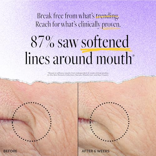 Microdermabrasion Keratosis Pilaris, Folliculitis & Acne Exfoliating Deep Cleansing Scrub Soap, KP Bump Eraser, Back & Butt Acne Exfoliant, Wash Cleanser - Rough, Bumpy & Dry Skin Gets Rid Of Redness