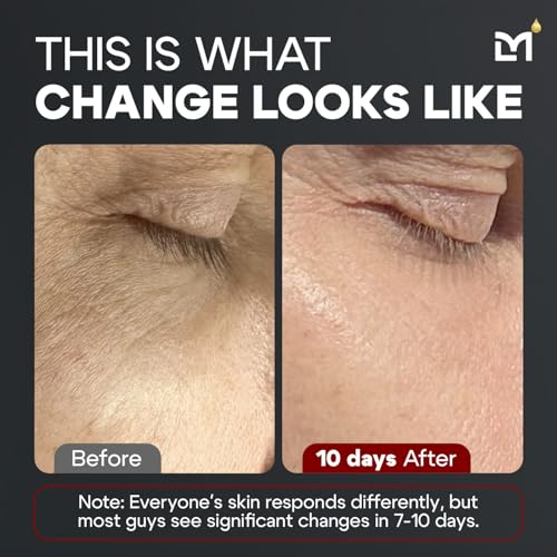 Titan MAX Anti-Aging Peptides Serum for Face ? Utra Potency Mens Peptide Serum Moisturizer ? Skin Care Men ? Face Serum Men ? Anti Aging Serum ? 10% Niacinamide, HA ? All Skin Types?Unscented