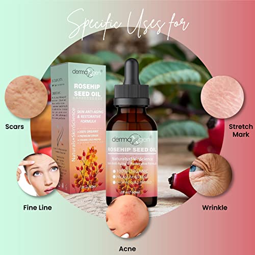 Rosehip Seed Oil 2 Fl Oz -100% Organic & Cold Pressed - Anti-aging Moisturizing Treatment For Face, Hair, Skin & Nails, Acne Scars, Anti-wrinkle.