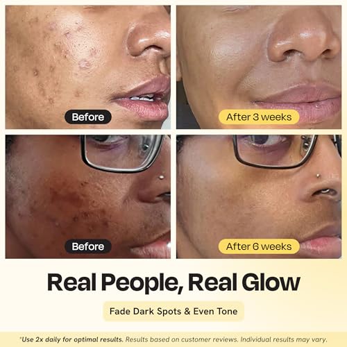 Gleamin Advanced Brightening Moisturizer - Facial Cream with Shea Butter, Vitamin C and Ceramides, Helps Improve the Look of Dark Spots, Uneven Tone & Deep Hydration, Fragrance Free - 1.7 fl oz