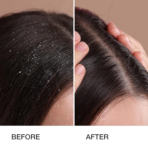 GK HAIR Global Keratin Anti Dandruff Shampoo 250ml Global Keratin Organic Argan Oil Hair Serum For Frizz Control Dry Damage Hair Repair 50ml