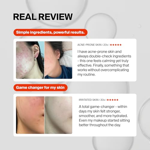Pixcell Biom 2B/mL Probiotic Essence - Restores Skin Barrier with Bifida, Lactobacillus Ferment Lysate, Korean Probiotic Drops for acne prone skin and sensitive skin (55ml, 1.85 Fl Oz.)