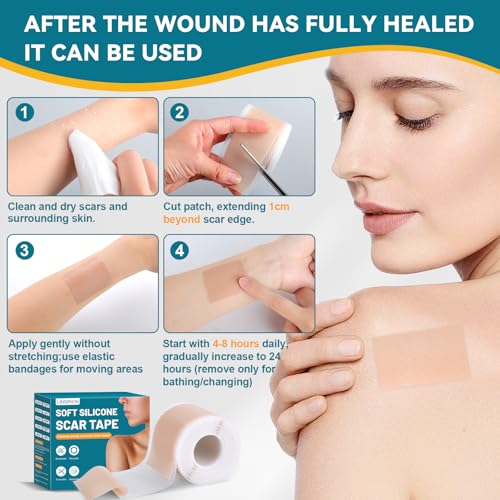 Silicone Scar Tape for Surgical Marks Face Stick Keloid Cover C-Section Strips Wrinkle Cream Lip Sleeping Gel Sheet Tummy Patch Hydrocolloid Roll Soft (1 Pack, 1.6"X 120")