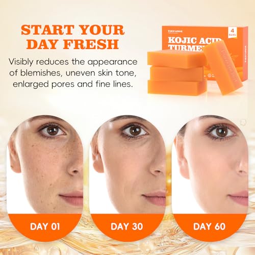 Turmeric Soap Bar Dark Spot Kojic Acid soap Remover for face and body Even Skin Tone, Moisturizing & Nourishing Natural Ingredients£¨4Pack£©