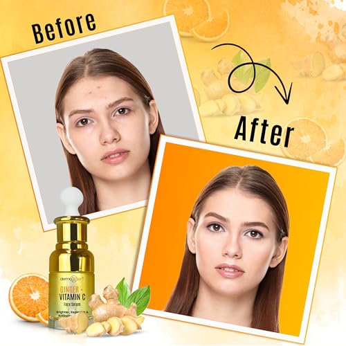 Ginger Vitamin C Serum for Face ? Organic Facial Serum with Hyaluronic Acid & Turmeric Root | Hydrating Moisturizer for Dull, Dry Skin ? Reduces Acne, Wrinkles & Hyperpigmentation - 1FL OZ