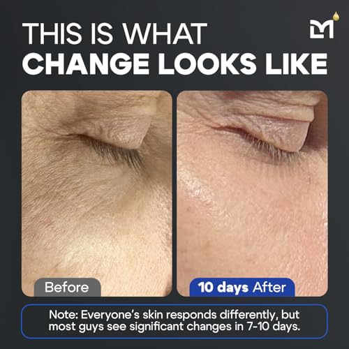 Titan Anti-Aging Peptides Serum for Face ? High Potency Mens Peptide Serum Moisturizer ? Skin Care for Men ? Face Serum Men ? Anti Aging Serum ? 5% Niacinamide, HA ? All Skin Types ?Unscented