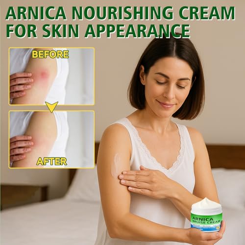 Arnica Bruise Cream, Advanced Formula Arnica Cream for Bruising and Swelling with Plant Extract, for Thin Skin on Face and Body 4 oz