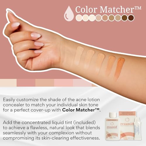 Acne Spot Treatment Lotion For Pimples - Skin Clearing Blemish Concealer For Oily Skin With 5% Sulfur & 2% Resorcinol - Sensitive Skin Makeup - Skin Tone Matching Foundation - 2oz