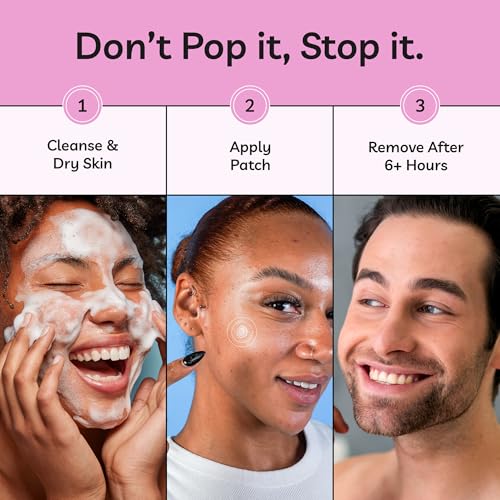 Spot Stoppers Pimple Patches - Invisible Spot Patches for Acne Treatment, Hydrocolloid Patches for Spot Treatment, Vegan & Cruelty Free Korean Skincare (30 Count (Pack of 1))