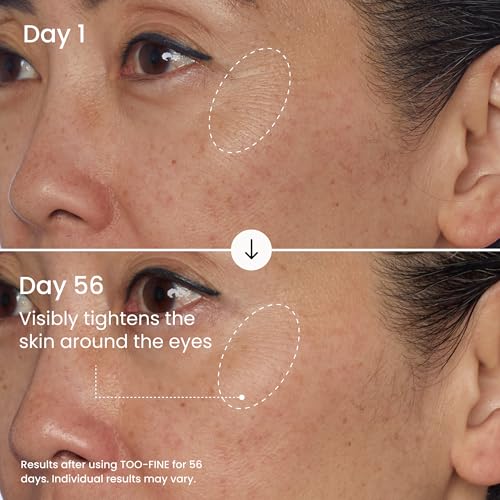 MA?LYS TOO-FINE Face Serum for Women - Firming Anti-Aging Serum with Glaucine & Bacillus Ferment - Helps Lift the Look of Sagging Skin on Jawline, Cheekbones & Under Eyes (15 mL)