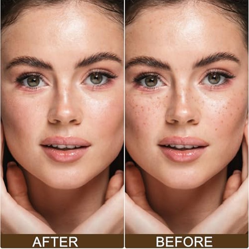 Freckle Stamp - Freckle Pen, Waterproof, Long-Lasting Fake Freckles Stain Marker Pencil Tool for Natural Lifelike Sunkissed Face Freckle Makeup, Quick Dry 5-Point Faux Freckle Stamp Cushion (Medium)