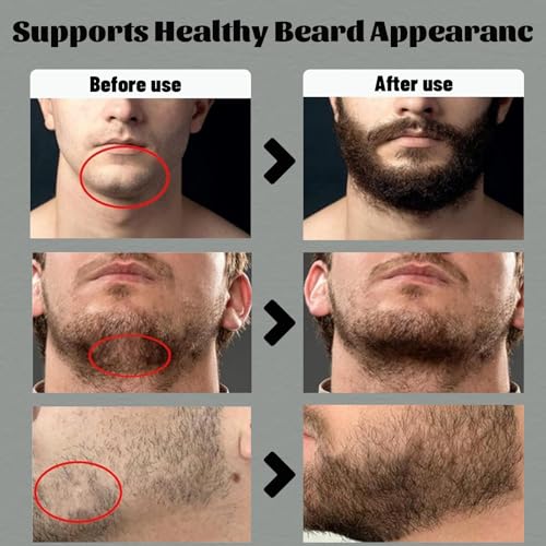 Para Barba, Estimulante De Barba, Beard Balm for Men, Crecimiento De Barba Para Hombre, Mustache Wax, B?lsamo Para Barba, Original Moisturizes & Strengthens Para Crecer La Barba Rapido Beard (1 PCS)
