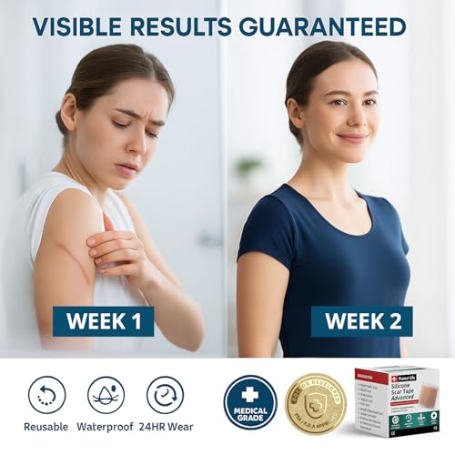 glow mini breathable blemish balm #white | light-coverage bb cream & tinted moisturizer | skincare-like finish with green tea leaf water infusion | healthy radiant non-comedogenic | 0.2 fl oz
