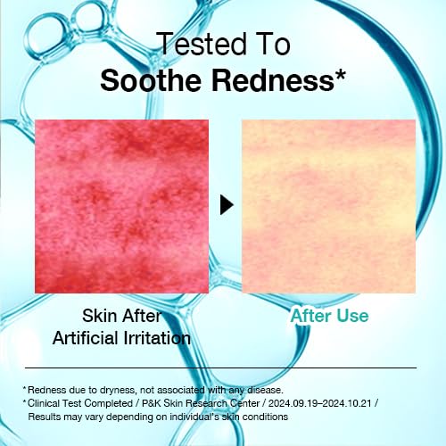 Intensive Calming Hydrogel Face Mask (5 Pack) ? Cooling Comfort for Dry, Tight, Stressed-Looking Skin; Helps Reduce the Appearance of Redness; PDRN (Sodium DNA) + Panthenol