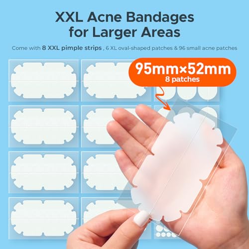 XXL Pimple Patches for Body, Large Acne Patches, 5 Sizes Big Hydrocolloid Bandages for Back, Chest, Shoulders Zit Breakouts, Blemish Stickers for Face (Oval, Dot 110 Count)