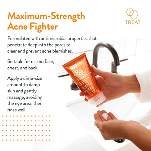 AcneFree Severe Acne 10% Benzoyl Peroxide Foaming Cleansing Wash,5 Ounce,(Pack of 2)