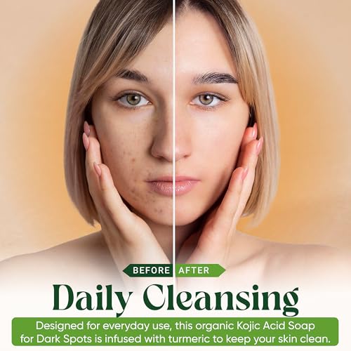 Turmeric Kojic Acid Soap Bars with Vitamin C, Retinol & Hyaluronic Acid ? Face & Body Soap with Collagen & Shea Butter ? 2-Pack Cleansing Bars for All Skin Types