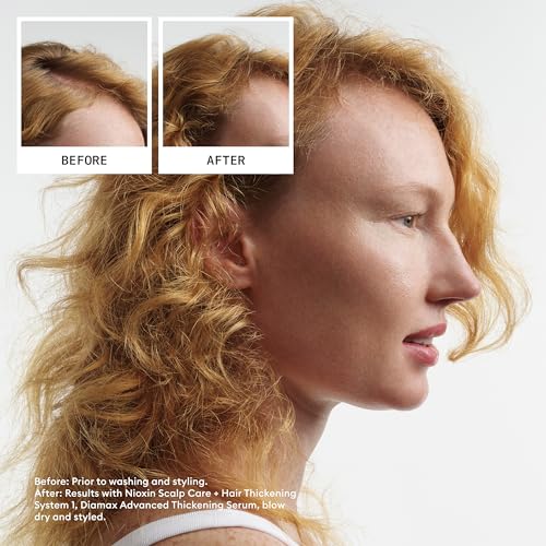 Nioxin System 1 Scalp + Hair Thickening Conditioner for Natural Hair with Light Thinning | Strengthen Against Breakage with Niacinamide & Biotin | Refreshed Scalp with Healthy Shine