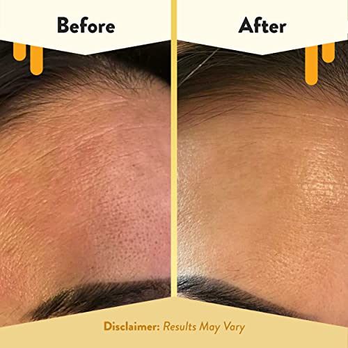 ECZEMA HONEY Oatmeal Facial Cleanser - Natural Eczema Face Wash Prevents Breakouts - Daily Gentle Face Cleanser for Dry, Itchy, Sensitive, & Irritable Skin (6 Oz)