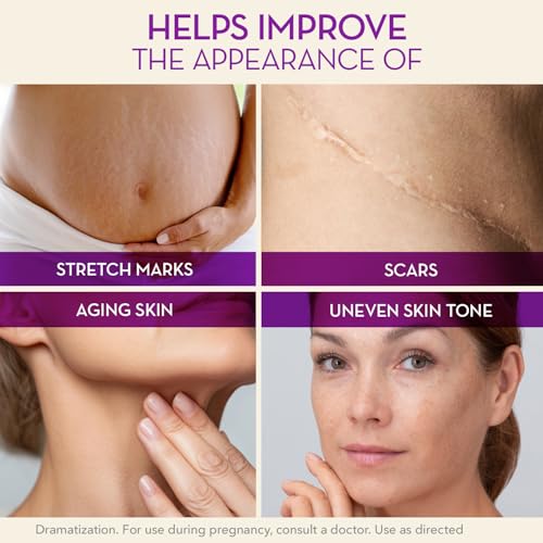 Cicatricure Cica Oil for Stretch Marks & Scars, Visible Results in 4 Weeks, Pregnancy Must-Haves Body Oil with Vitamin E, Stretch Mark Oil, Scar Treatment with Botanical Ingredients, 6.7 fl oz -3 Pack