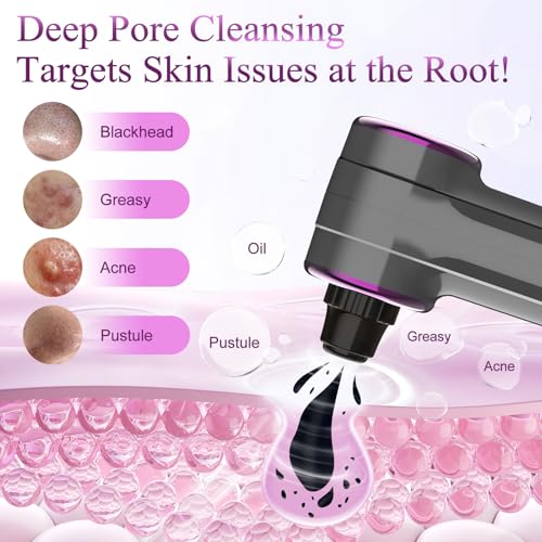 Blackhead Remover Vacuum, Pore Vacuum Cleaner with Heating, 3 Suction Levels & 9 Modes, Facial Pore Cleaner Tool for Nose, T-Zone, Chin, 5 Replaceable Heads, USB Rechargeable Comedone Extractor Kit