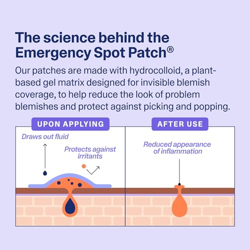 Curology Emergency Spot Pimple Patches for Face, Hydrocolloid Pimple Patches Fast-Acting, 160 Count