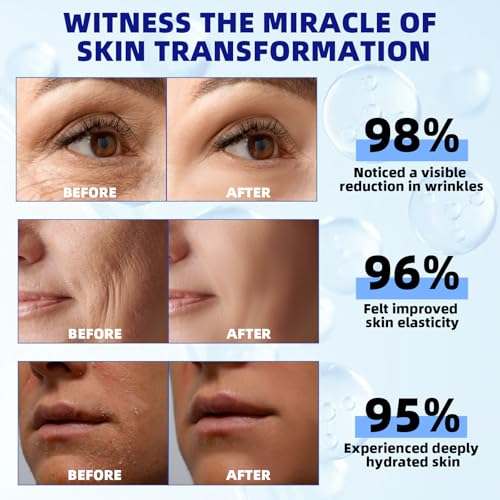 Retinol Serum for Face, 2.5% Retinol Intense Night Serum with Squalane,Vitamin C & E & B3,Hyaluronic Acid for Lines, Wrinkles & Premature Sun Damage to Resurface & Hydrate 30 ml/ 1 Fl oz